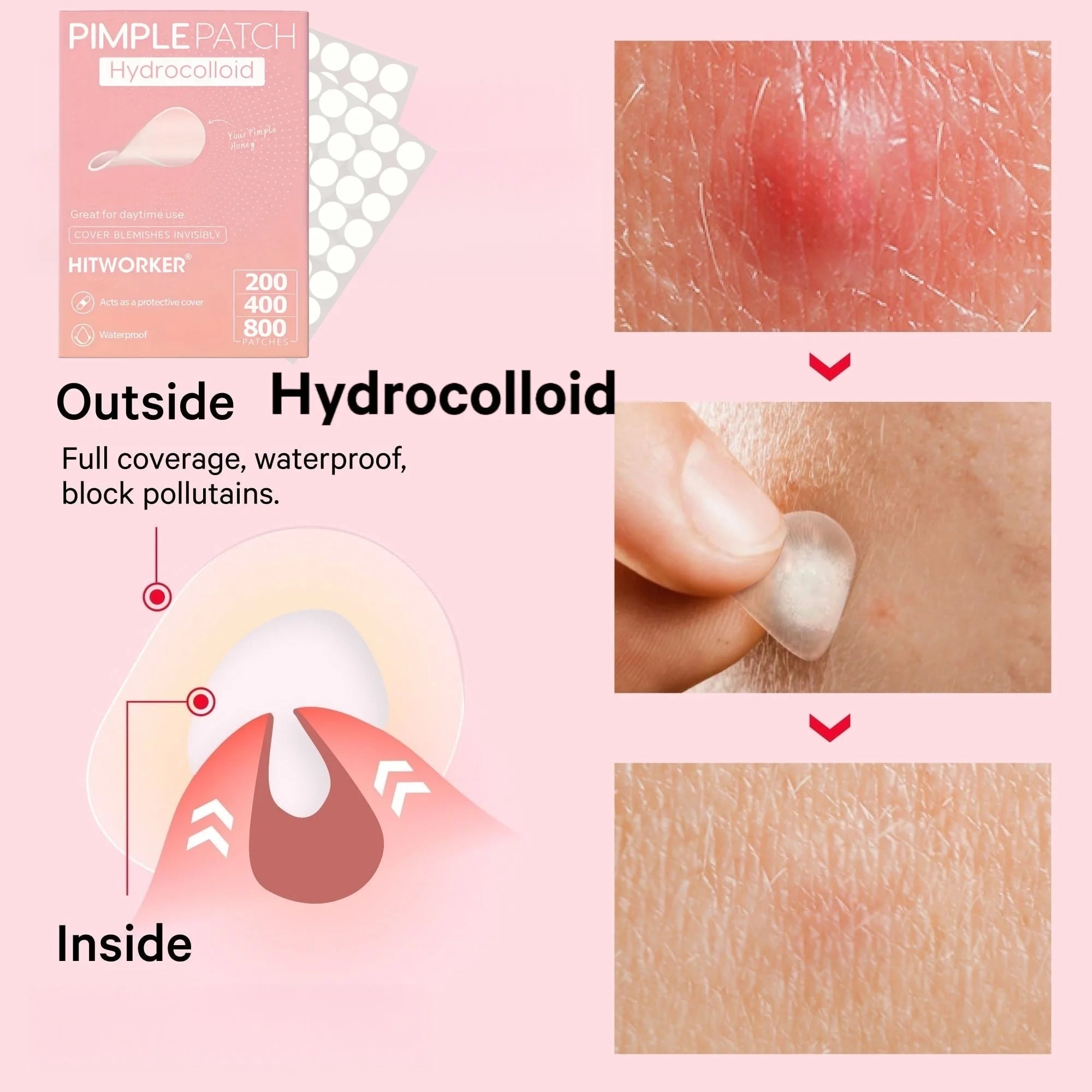 200/400/800 Pieces HITWORKER Hydrocolloid Acne Patches - Invisible, High-Quality Pimple Stickers with Salicylic Acid & Tea Tree