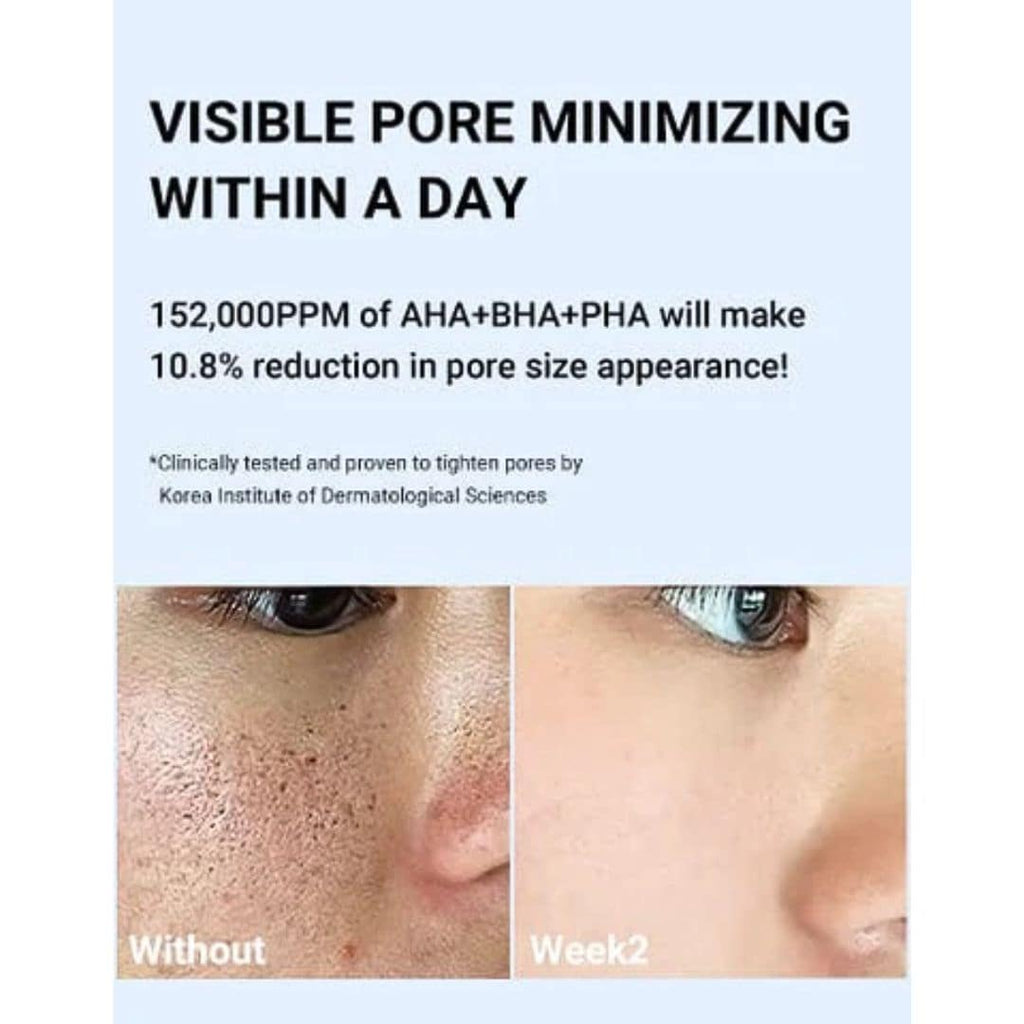 (3 Units) Zero Pore One Day Serum Bundle 30ml