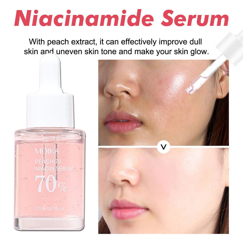 Niacinamide Serum Dark Spot Correcting Moisturizing Brightening