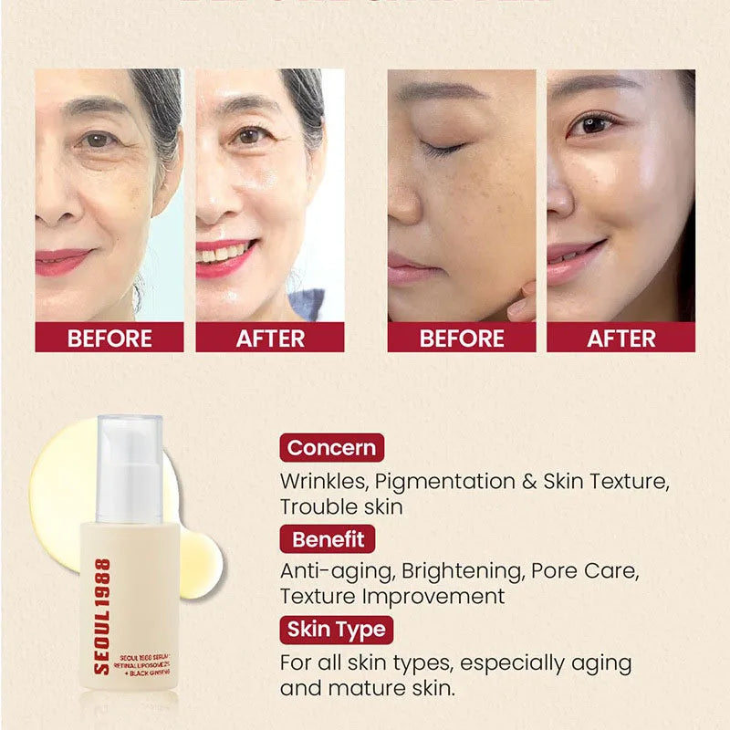1/2PCS Korean SEOUL 1988 Retinol Face Serum Fade Fine Wrinkle