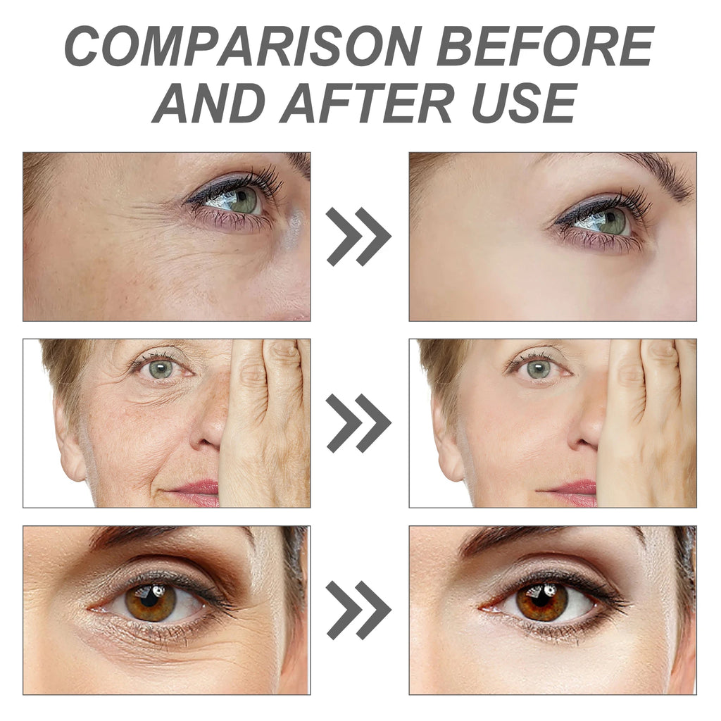 1/2PCS Korean SEOUL 1988 Retinol Face Serum Fade Fine Wrinkle