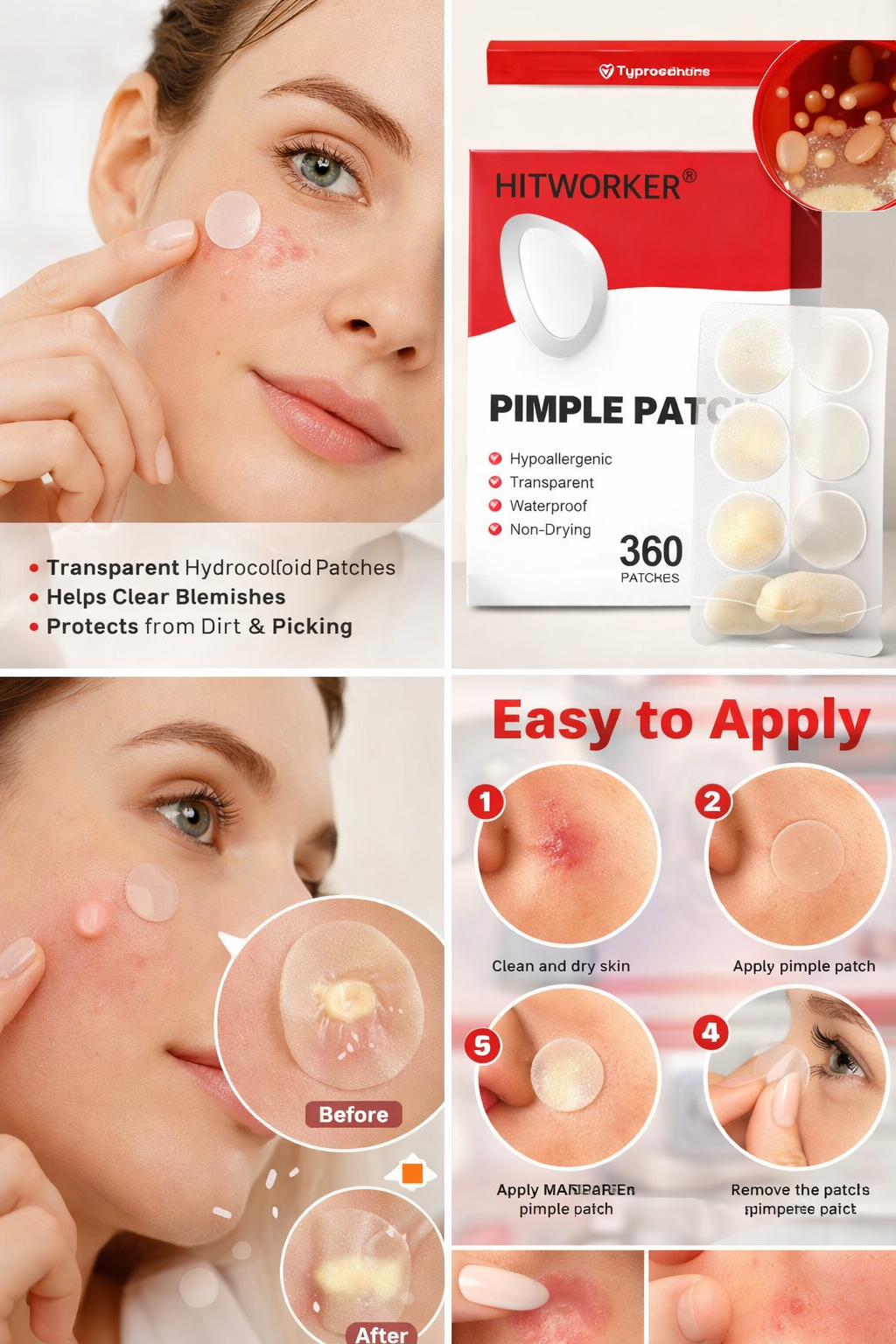 360Count Acne Patch, Covers Pimple And Acne, Acne Pimple Patch for Covering Zits And Blemishes, Spot Stickers for Face And Skin